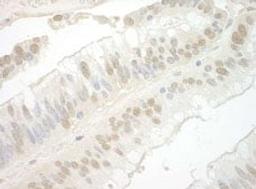 Detection of human Importin 7 by immunohistochemistry.