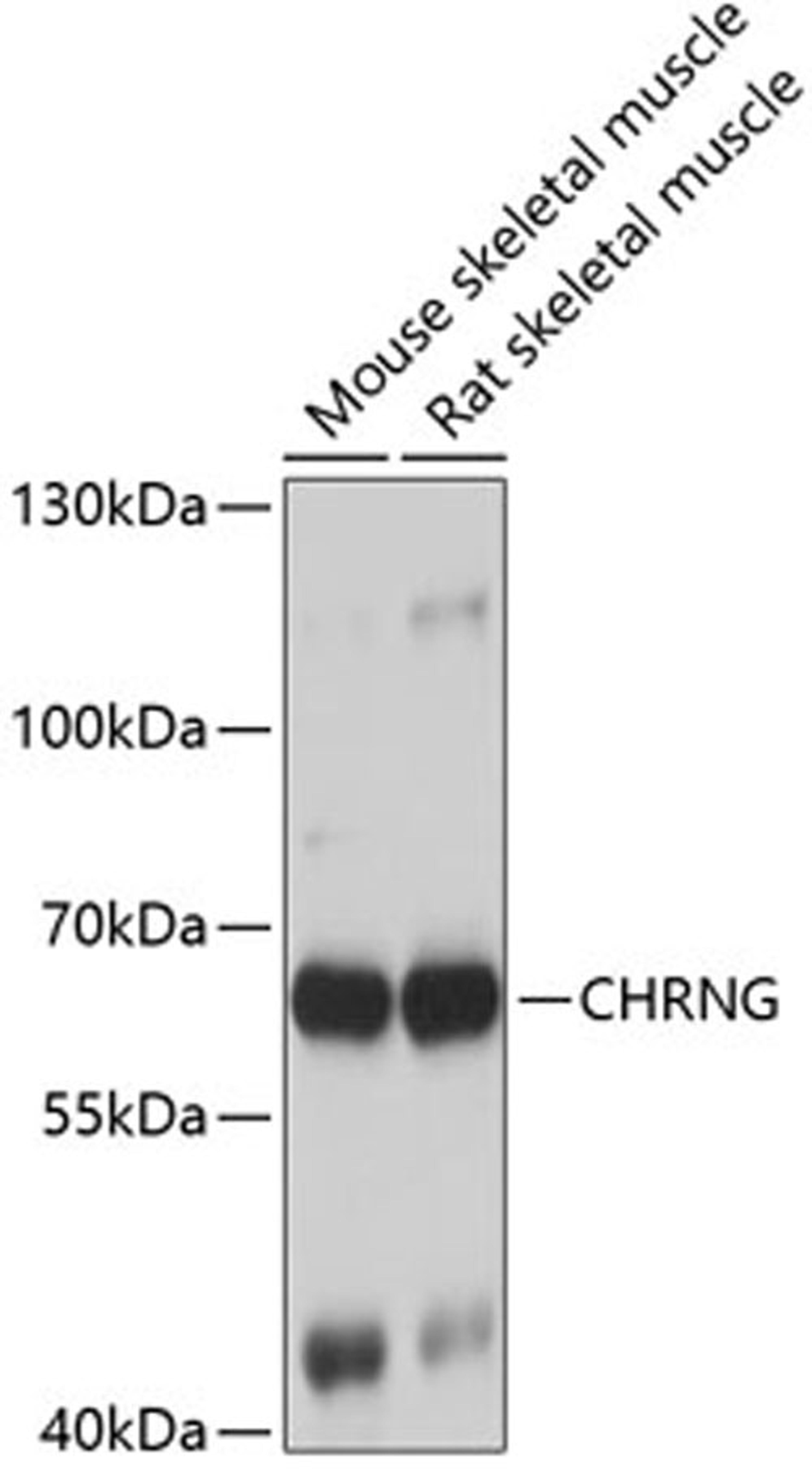 Western blot - CHRNG antibody (A7884)