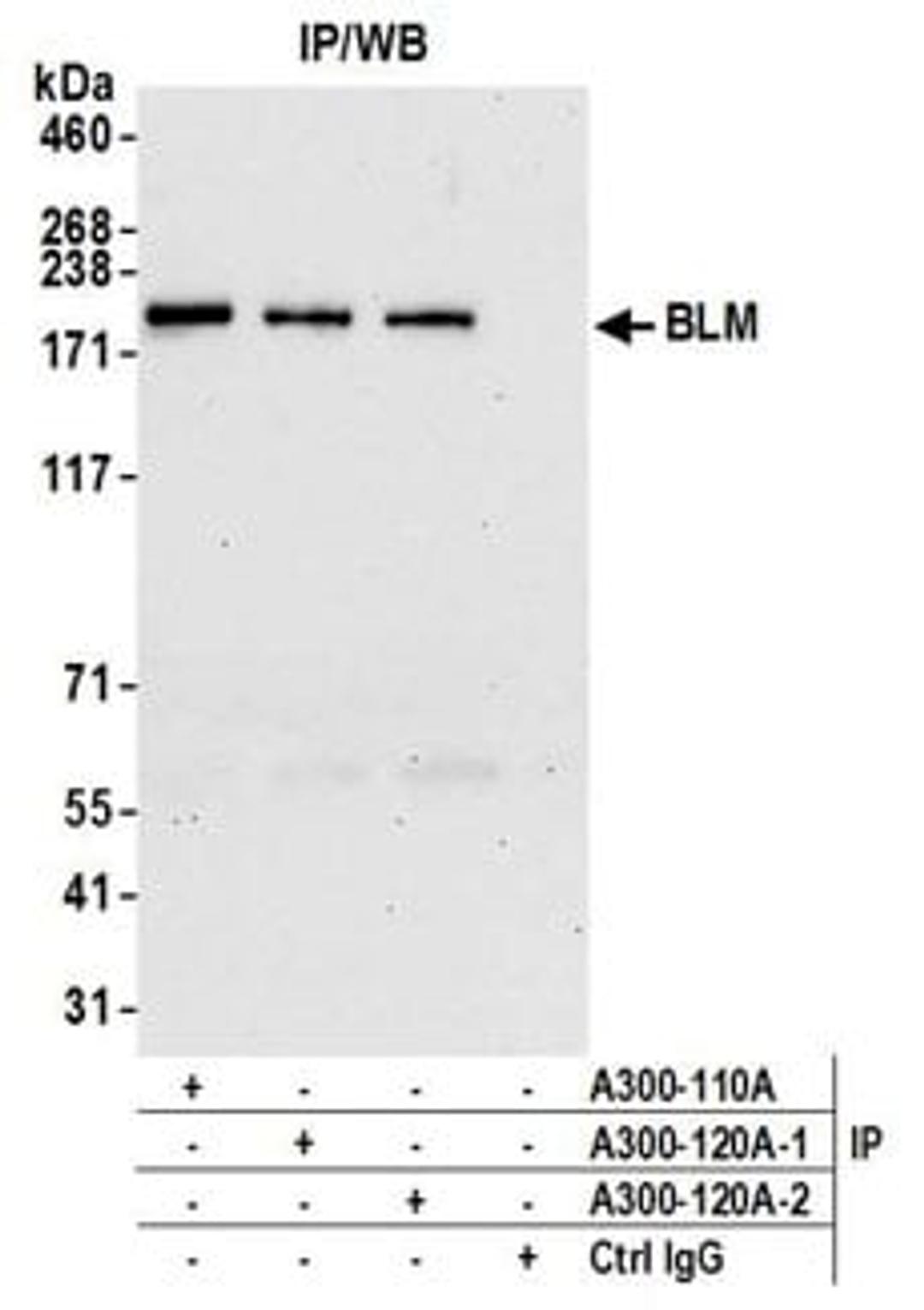 Detection of human BLM by western blot of immunoprecipitates.