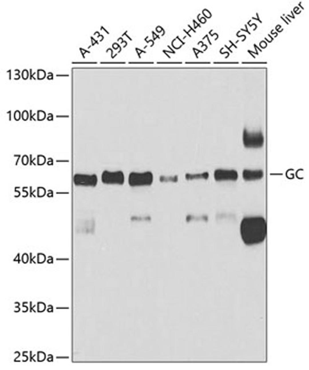 Western blot - GC antibody (A5709)