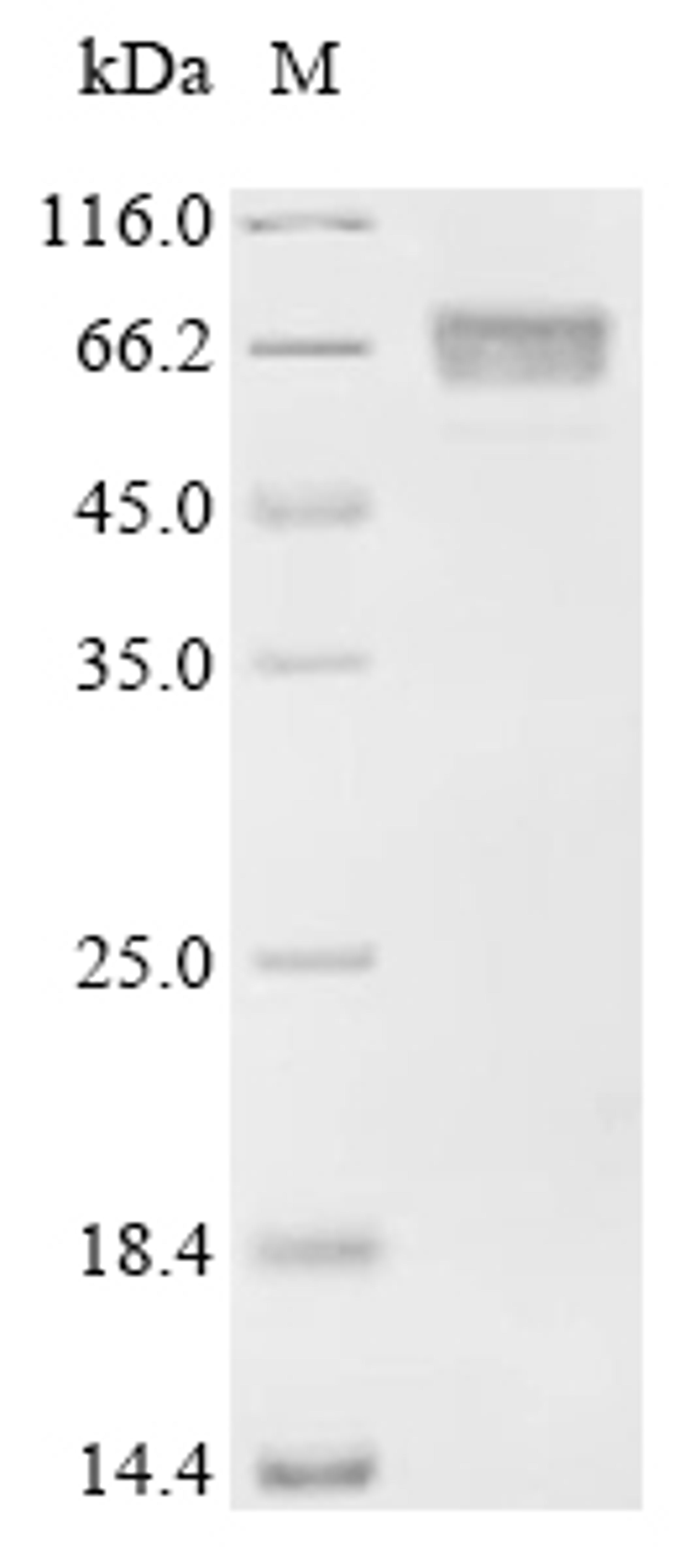 (Tris-Glycine gel) Discontinuous SDS-PAGE (reduced) with 5% enrichment gel and 15% separation gel.
