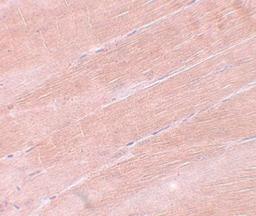 Immunohistochemistry-Paraffin: MYBPC2 Antibody [NBP1-77133] - Mouse skeletal muscle tissue with MYBPC2 antibody at 5 ug/mL.