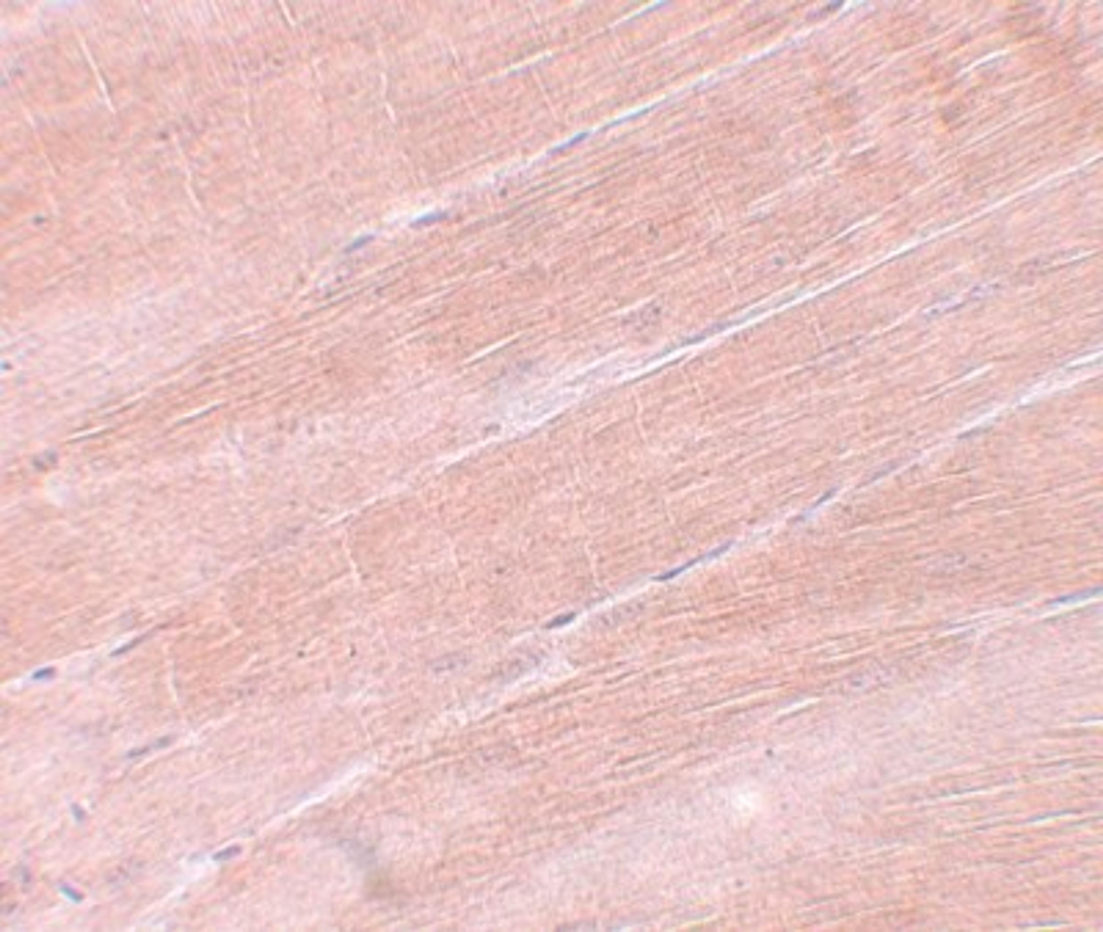 Immunohistochemistry-Paraffin: MYBPC2 Antibody [NBP1-77133] - Mouse skeletal muscle tissue with MYBPC2 antibody at 5 ug/mL.