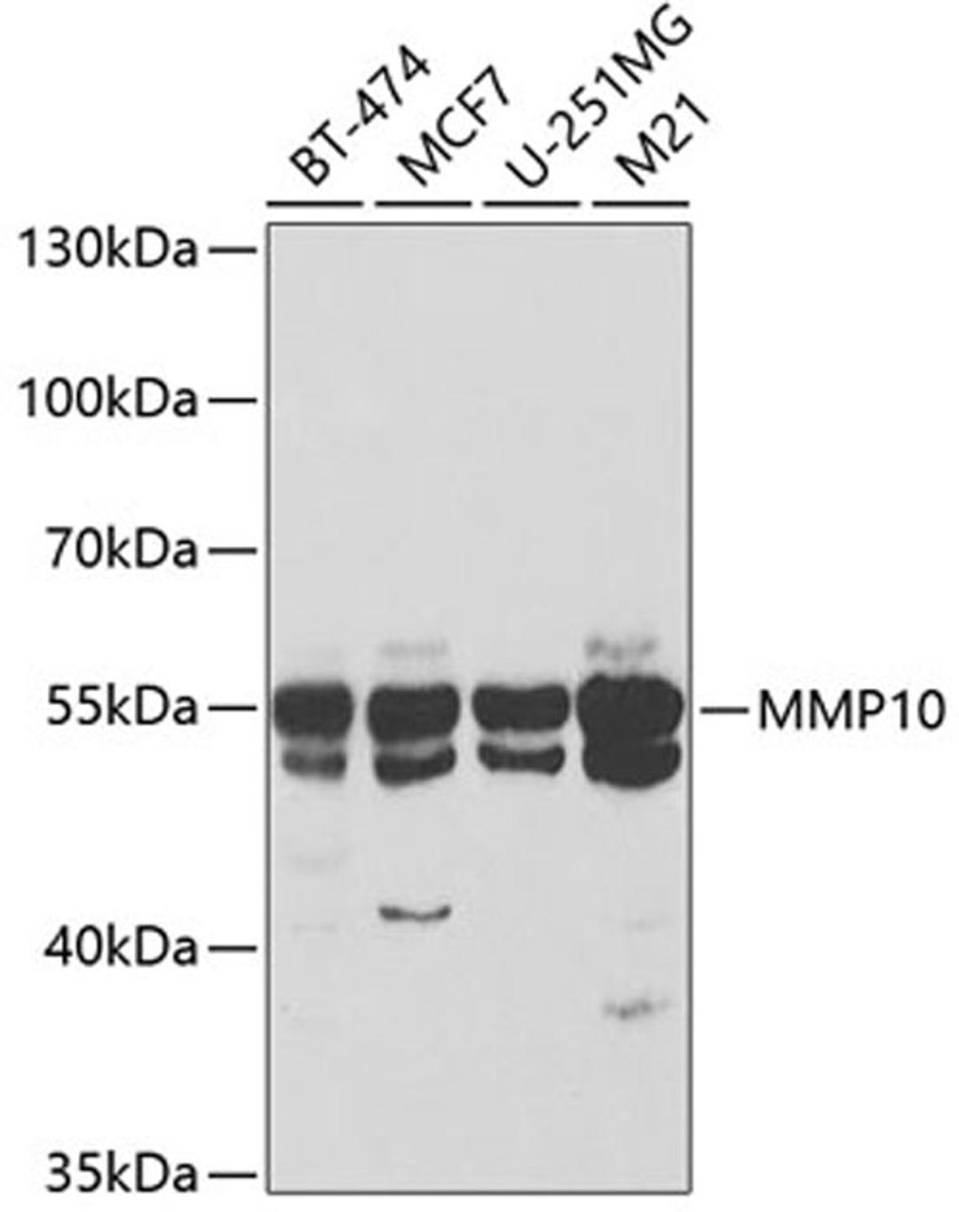 Western blot - MMP10 antibody (A3033)