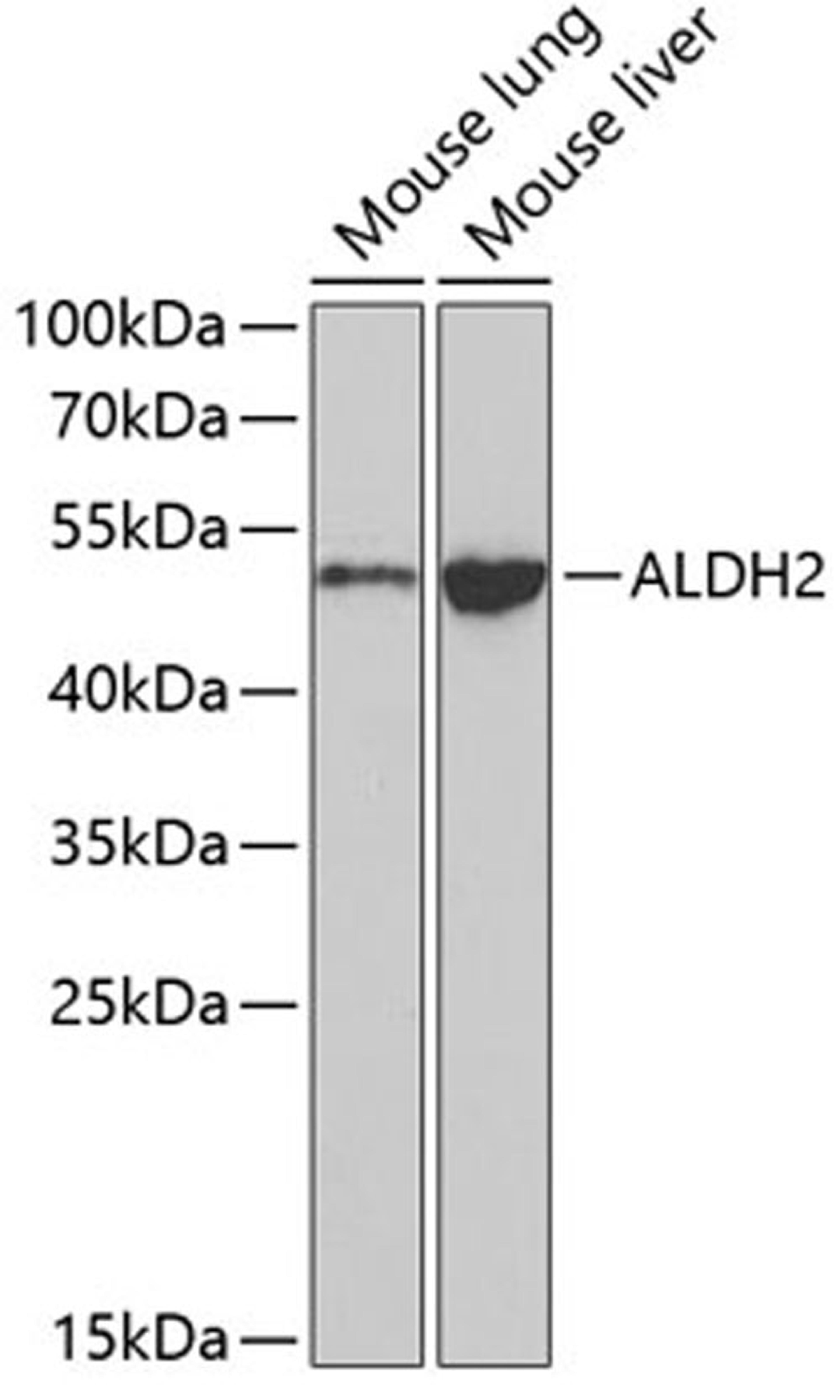 Western blot - ALDH2 antibody (A1226)