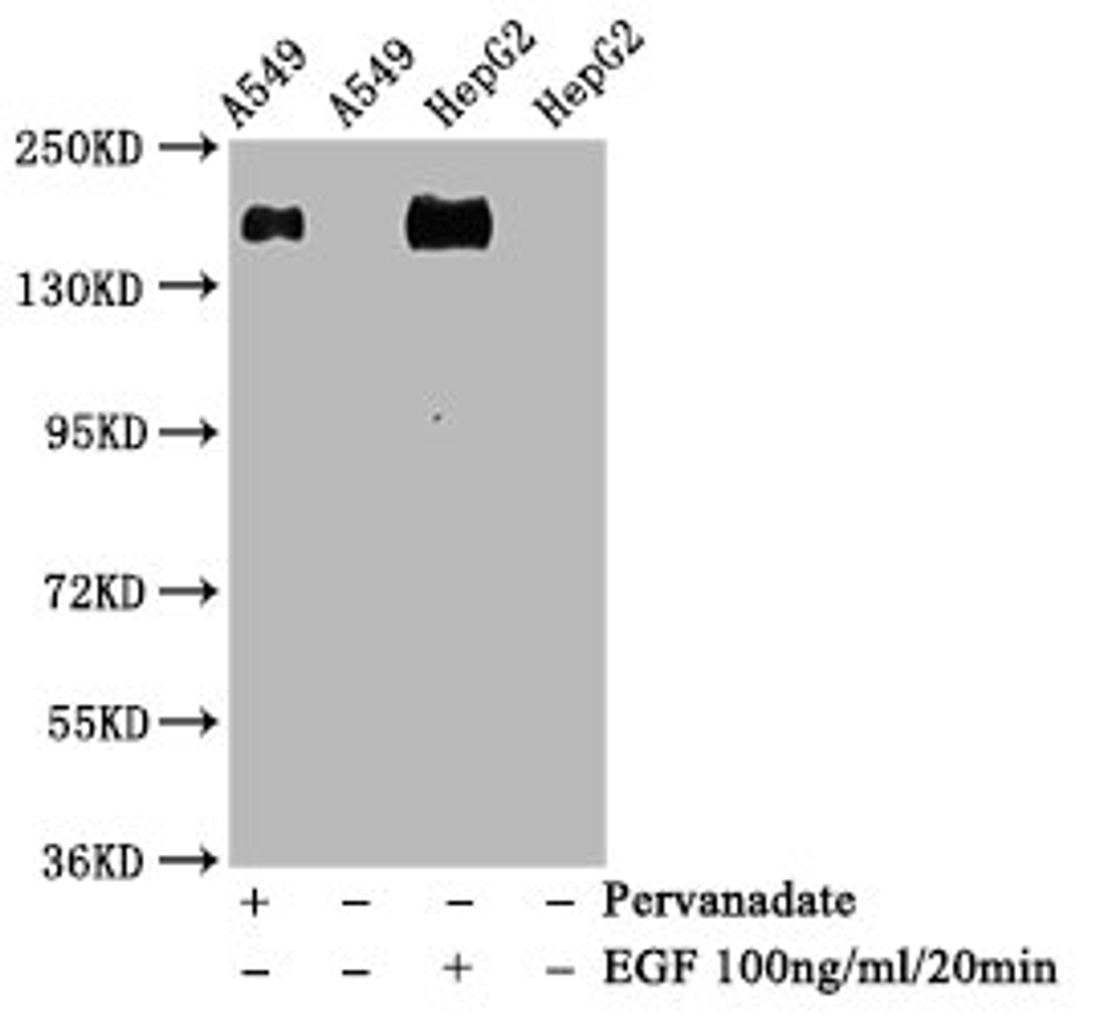 Western Blot. Positive WB detected in A549 whole cell lysate锛孒epG2 whole cell lysate(treated with EGF or Pervanadate). All lanes Phospho-EGFR antibody at 1.28μg/ml. Secondary. Goat polyclonal to rabbit IgG at 1/50000 dilution. Predicted band size: 175 KDa. Observed band size: 175 KDa.