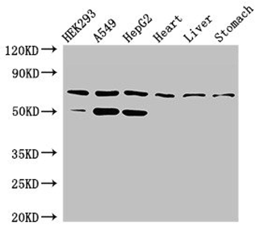 Western Blot. Positive WB detected in: HEK293 whole cell lysate, A549 whole cell lysate, HepG2 whole cell lysate, Rat heart tissue, Rat liver tissue, Rat stomach tissue. All lanes: TCTN3 antibody at 3.5µg/ml. Secondary. Goat polyclonal to rabbit IgG at 1/50000 dilution. Predicted band size: 67, 48, 23, 51 kDa. Observed band size: 67, 51 kDa