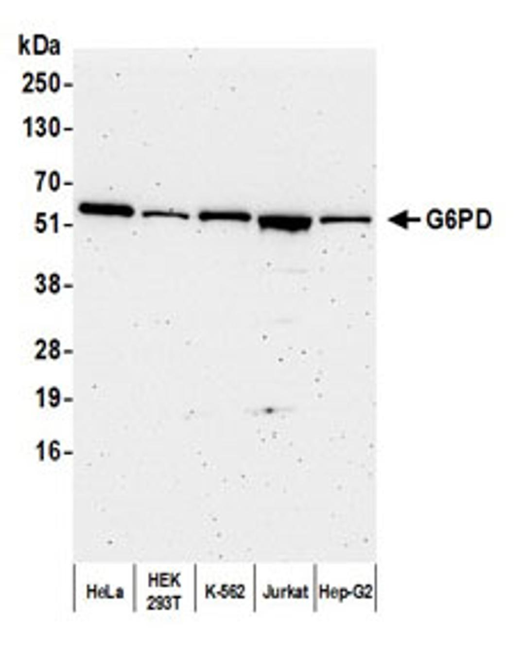 Detection of human G6PD by western blot.