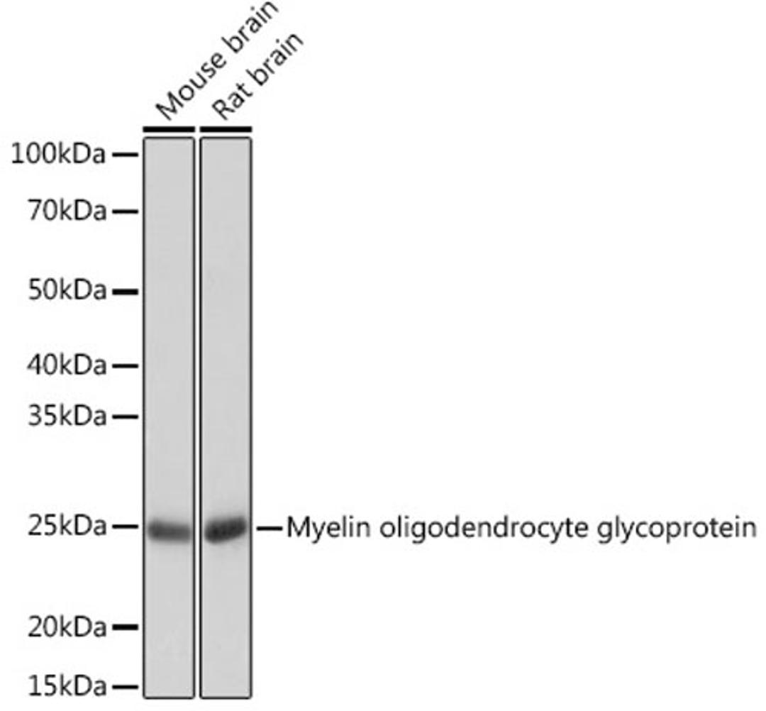 Western blot - Myelin oligodendrocyte glycoprotein Rabbit mAb (A3992)