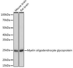 Western blot - Myelin oligodendrocyte glycoprotein Rabbit mAb (A3992)