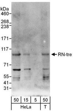 Detection of human RN-tre by western blot.