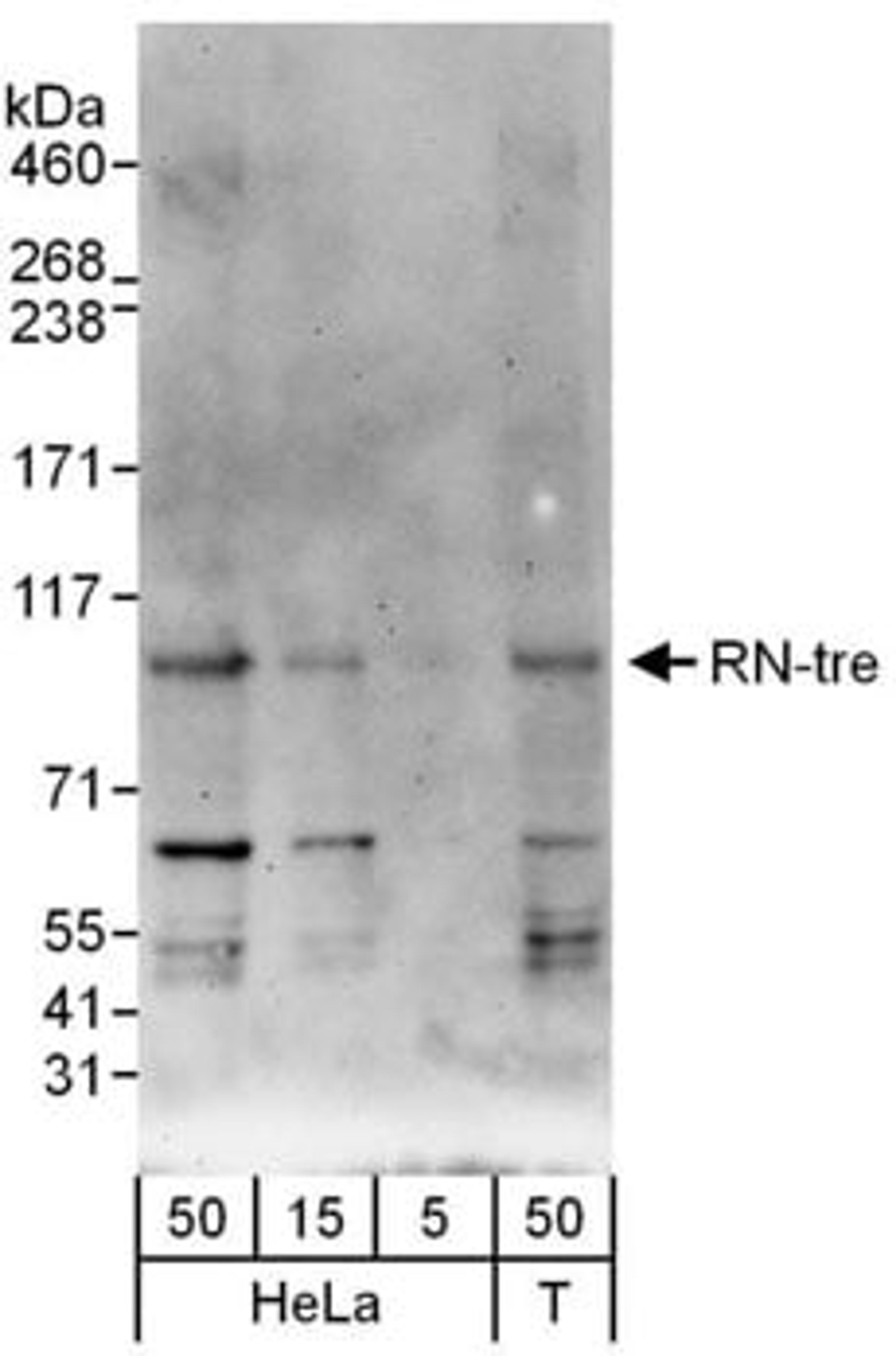 Detection of human RN-tre by western blot.