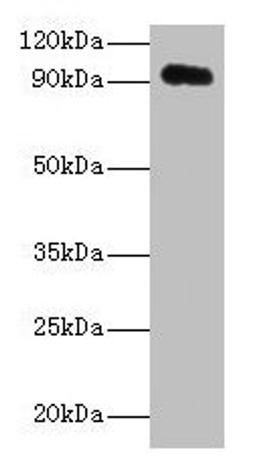 Western blot. All lanes: APP antibody at 2µg/ml + HL60 whole cell lysate. Secondary. Goat polyclonal to rabbit IgG at 1/10000 dilution. Predicted band size: 87, 35, 77, 79, 81, 83, 85, 86, 73 kDa. Observed band size: 95 kDa