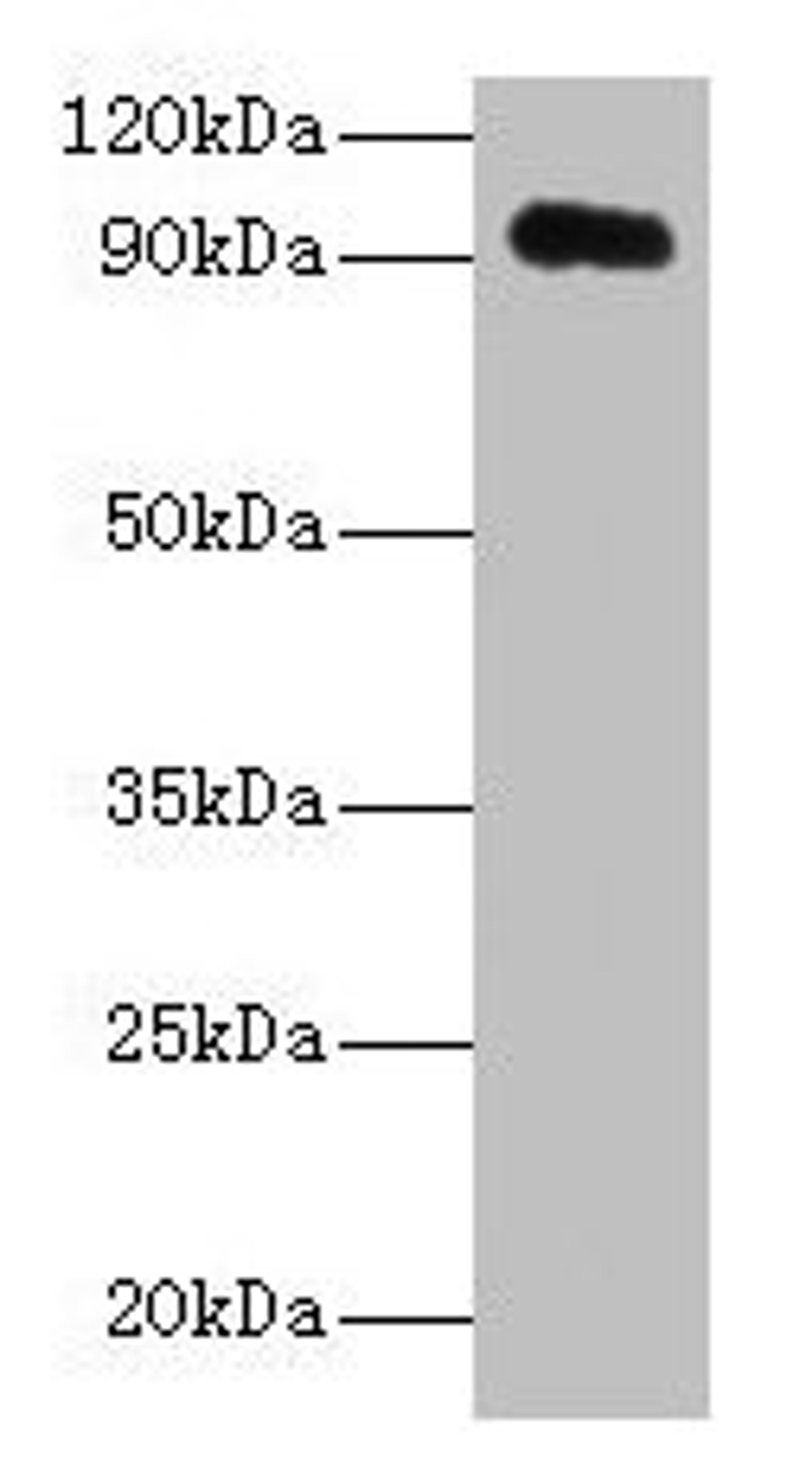 Western blot. All lanes: APP antibody at 2µg/ml + HL60 whole cell lysate. Secondary. Goat polyclonal to rabbit IgG at 1/10000 dilution. Predicted band size: 87, 35, 77, 79, 81, 83, 85, 86, 73 kDa. Observed band size: 95 kDa