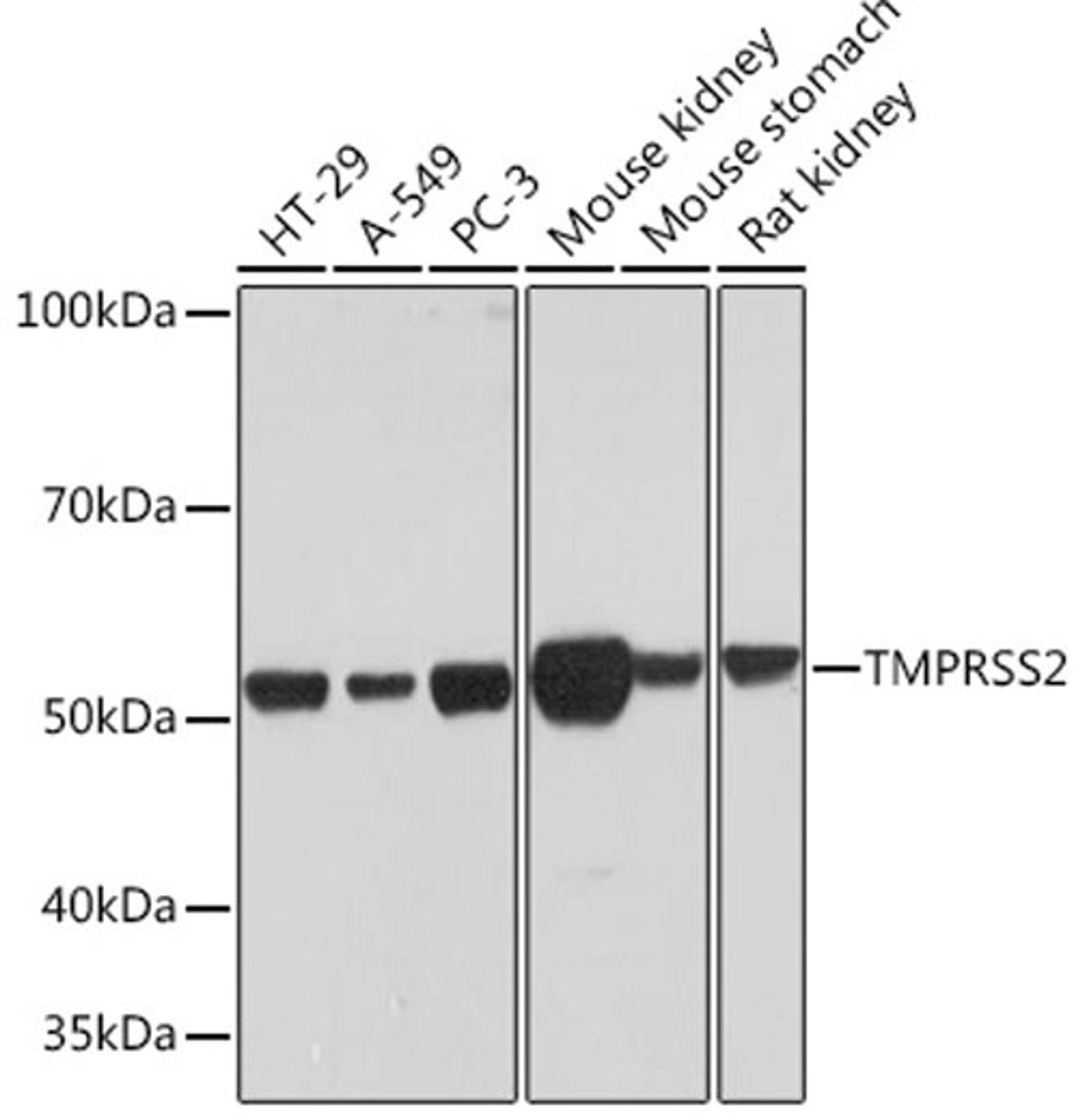 Western blot - TMPRSS2 Rabbit mAb (A9126)