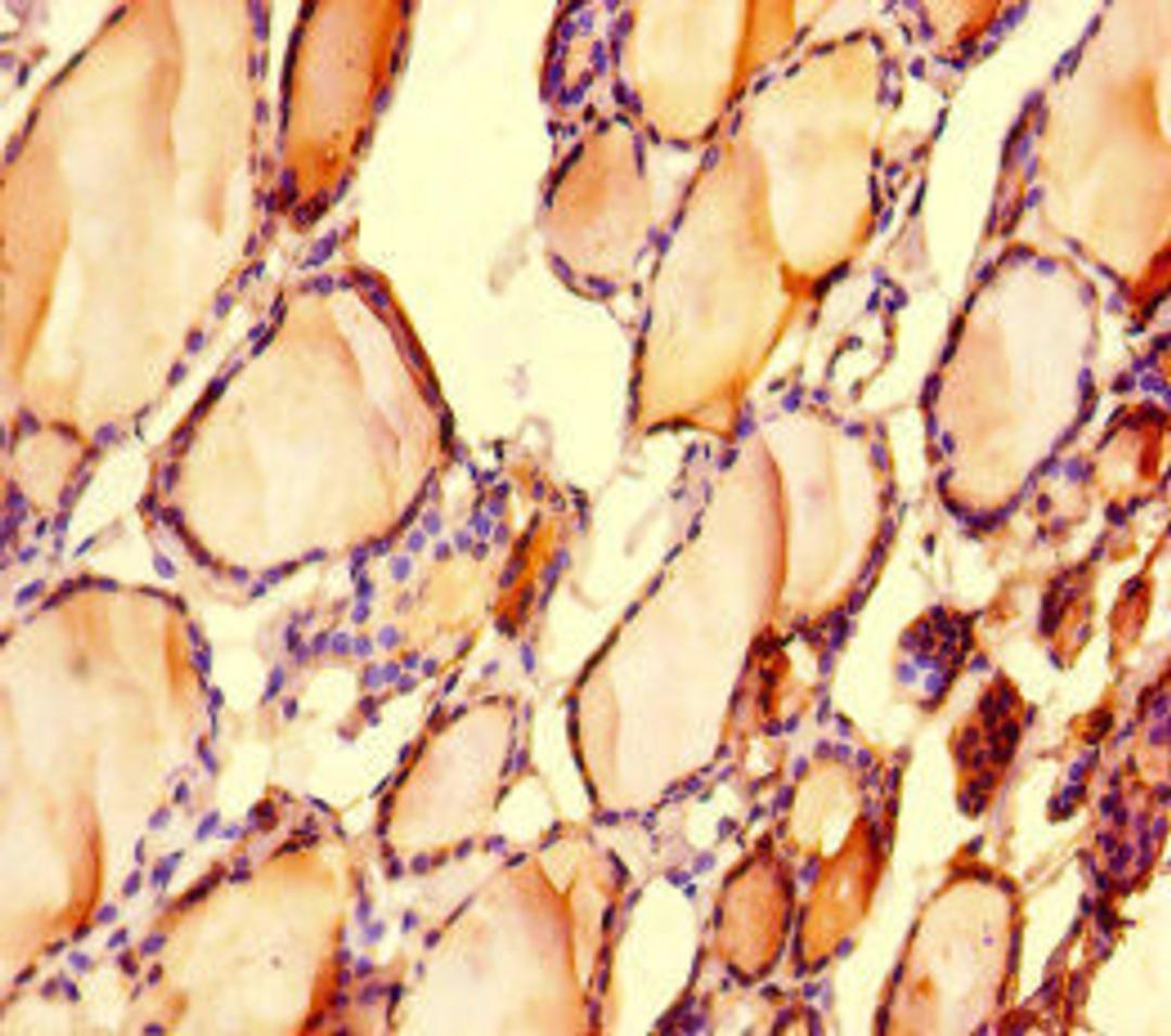 Immunohistochemistry of paraffin-embedded human thyroid tissue using CSB-PA013032LA01HU at dilution of 1:100