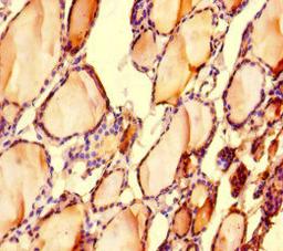 Immunohistochemistry of paraffin-embedded human thyroid tissue using CSB-PA013032LA01HU at dilution of 1:100