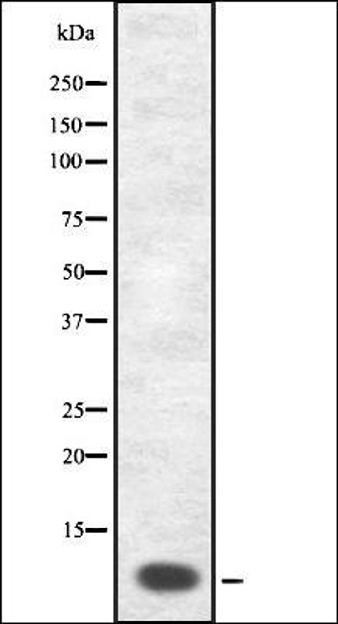 Western blot analysis of COS7 whole cell lysates using GnRH I antibody