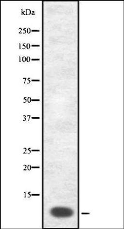 Western blot analysis of COS7 whole cell lysates using GnRH I antibody