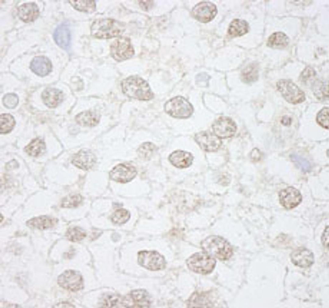 Detection of human DMWD by immunohistochemistry.