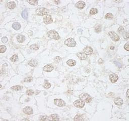 Detection of human DMWD by immunohistochemistry.