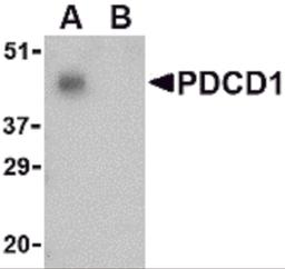 Western blot analysis of PD-1 in THP-1 cell lysate with PD-1 antibody at 1 μg/mL in the (A) absence and (B) presence of blocking peptide.