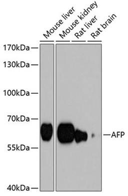 Western blot - AFP antibody (A0200)