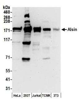 Detection of human and mouse Alsin by western blot.