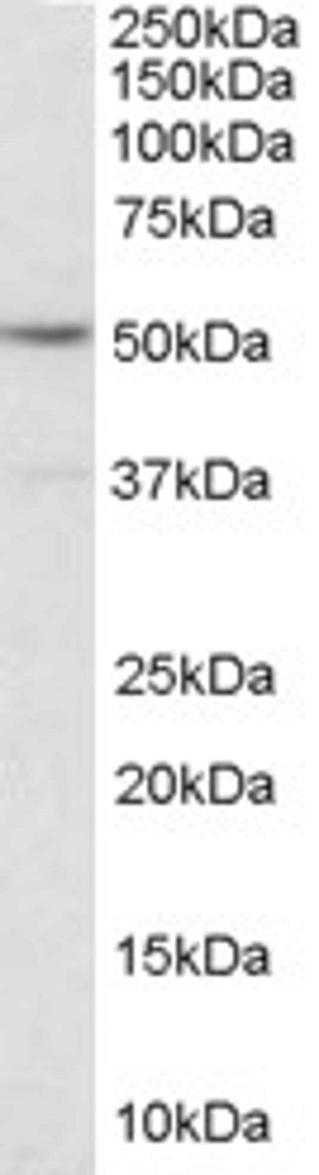 46-356 (1ug/ml) staining of EBV immortalised Lymphoblastoid lysate (35ug protein in RIPA buffer). Primary incubation was 1 hour. Detected by chemiluminescence.