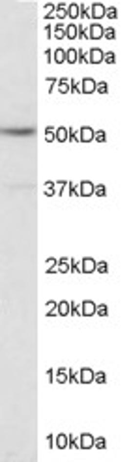 46-356 (1ug/ml) staining of EBV immortalised Lymphoblastoid lysate (35ug protein in RIPA buffer). Primary incubation was 1 hour. Detected by chemiluminescence.