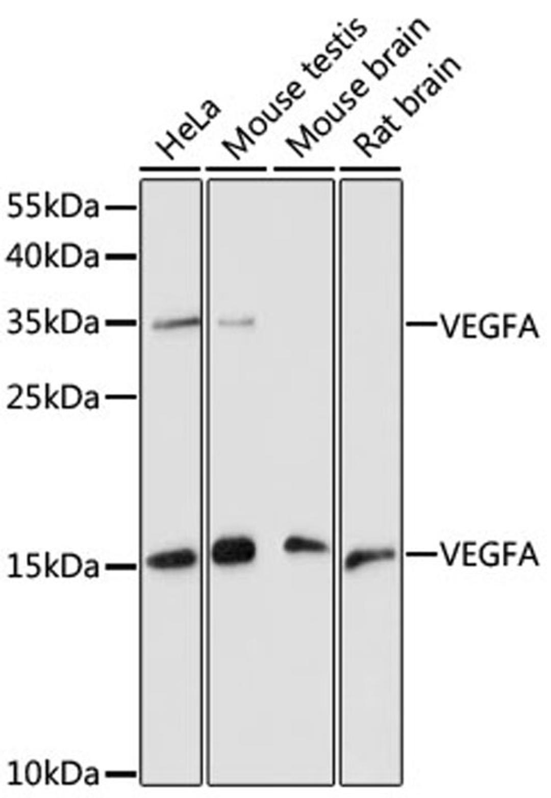 Western blot - VEGFA antibody (A0280)