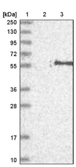 Western Blot: FAR2 Antibody [NBP1-90435] - Lane 1: Marker [kDa] 250, 130, 95, 72, 55, 36, 28, 17, 10<br/>Lane 2: Negative control (vector only transfected HEK293T lysate)<br/>Lane 3: Over-expression lysate (Co-expressed with a C-terminal myc-DDK tag (~3.1 kDa) in mammalian HEK293T cells, LY413315)