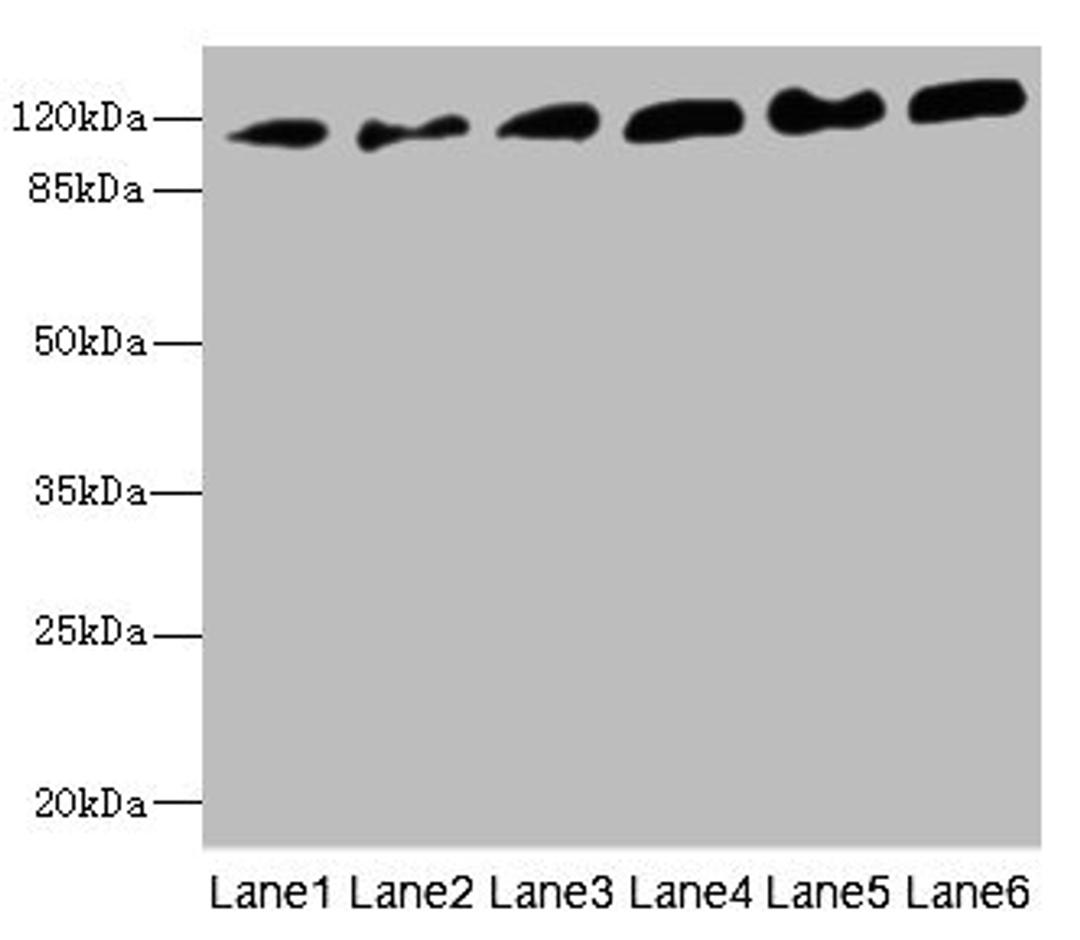 Western blot. All lanes: PCDH1 antibody at 2.56ug/ml. Lane 1: A431 whole cell lysate. Lane 2: Human breast cancer cell. Lane 3: Jurkat whole cell lysate. Lane 4: Hela whole cell lysate. Lane 5: NIH/3T3 whole cell lysate. Lane 6: 293T whole cell lysate. Secondary. Goat polyclonal to rabbit IgG at 1/10000 dilution. Predicted band size: 115, 134 kDa. Observed band size: 115 kDa. 