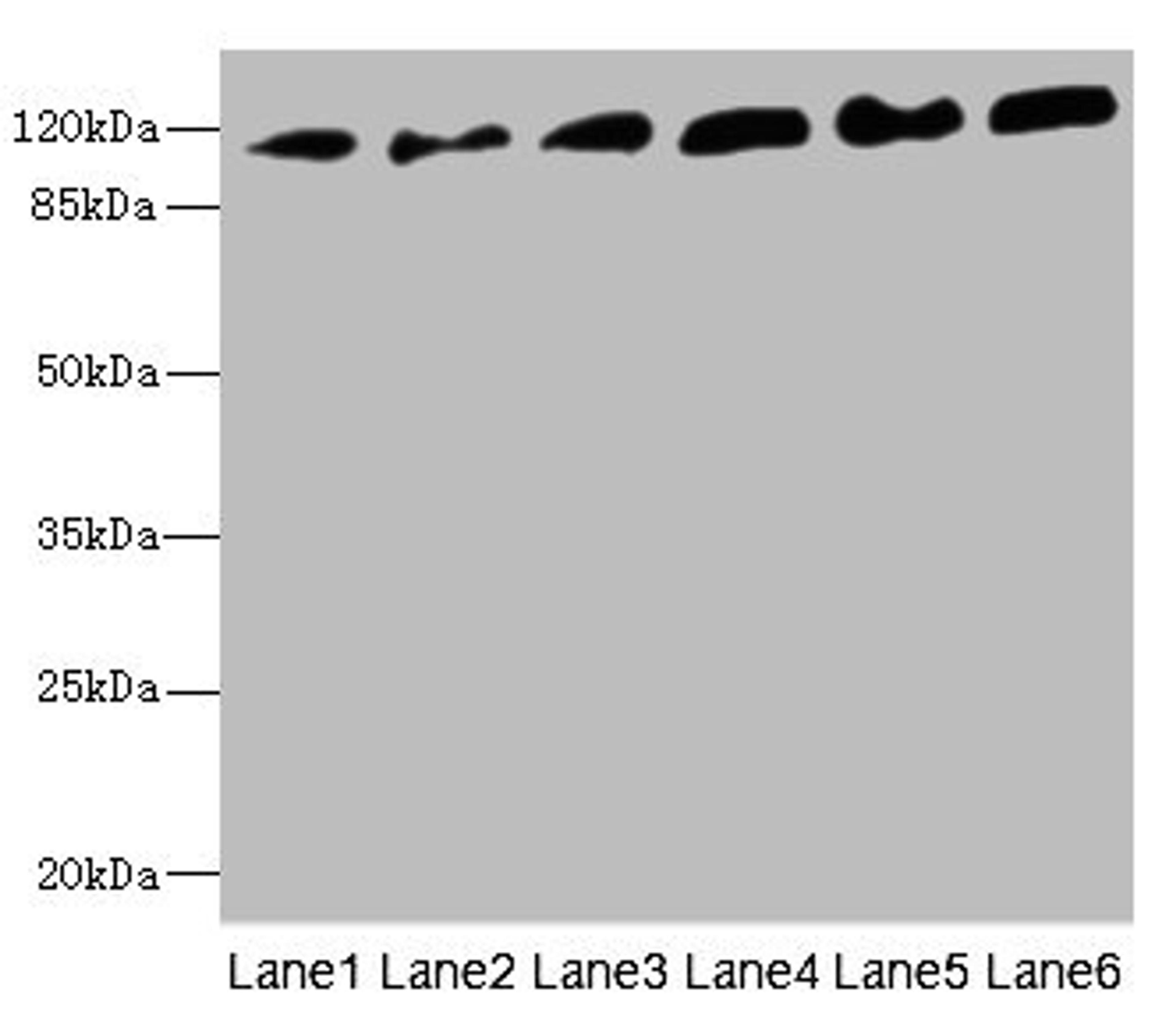 Western blot. All lanes: PCDH1 antibody at 2.56ug/ml. Lane 1: A431 whole cell lysate. Lane 2: Human breast cancer cell. Lane 3: Jurkat whole cell lysate. Lane 4: Hela whole cell lysate. Lane 5: NIH/3T3 whole cell lysate. Lane 6: 293T whole cell lysate. Secondary. Goat polyclonal to rabbit IgG at 1/10000 dilution. Predicted band size: 115, 134 kDa. Observed band size: 115 kDa. 