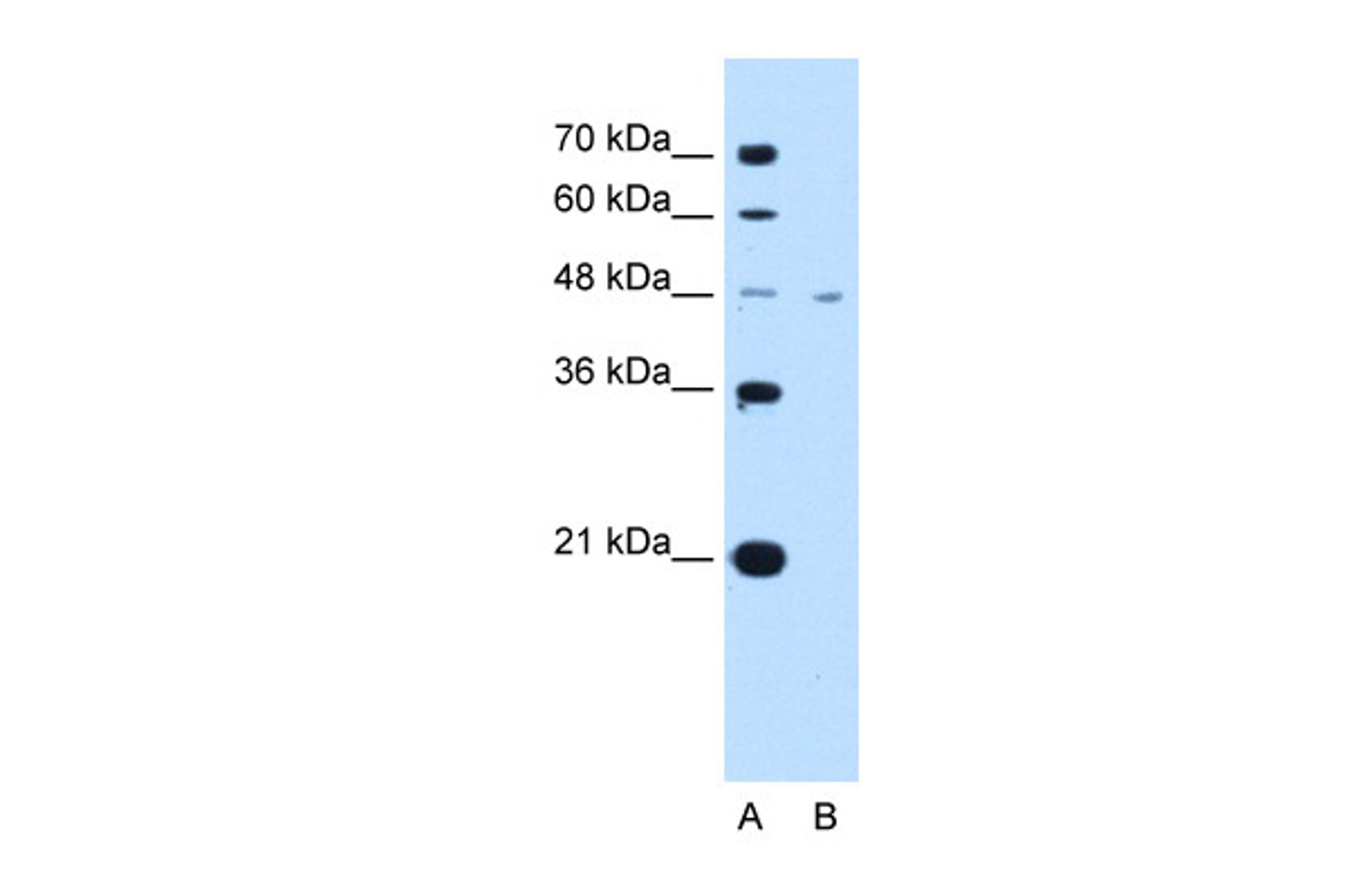 Antibody used in WB on Human Jurkat 2.5 ug/ml.