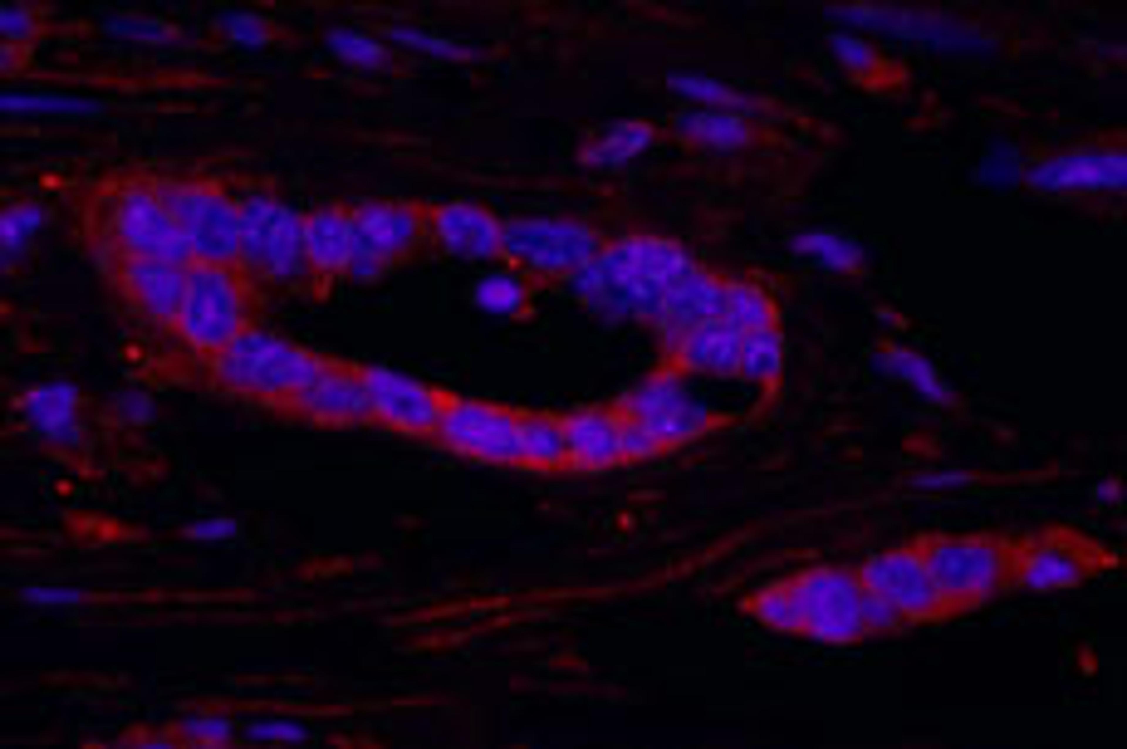 Detection of human RSK2 by immunohistochemistry.