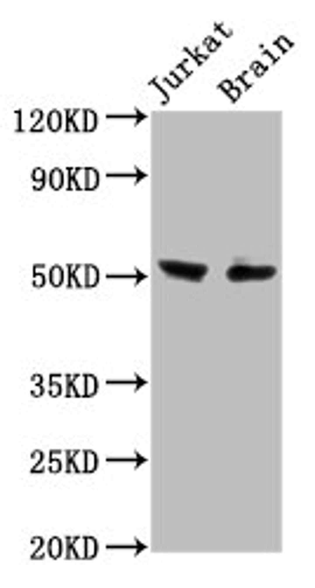 Western Blot. Positive WB detected in: Jurkat whole cell lysate, Rat brain tissue. All lanes: ONECUT1 antibody at 7.6ug/ml. Secondary. Goat polyclonal to rabbit IgG at 1/50000 dilution. Predicted band size: 52 kDa. Observed band size: 52 kDa. 
