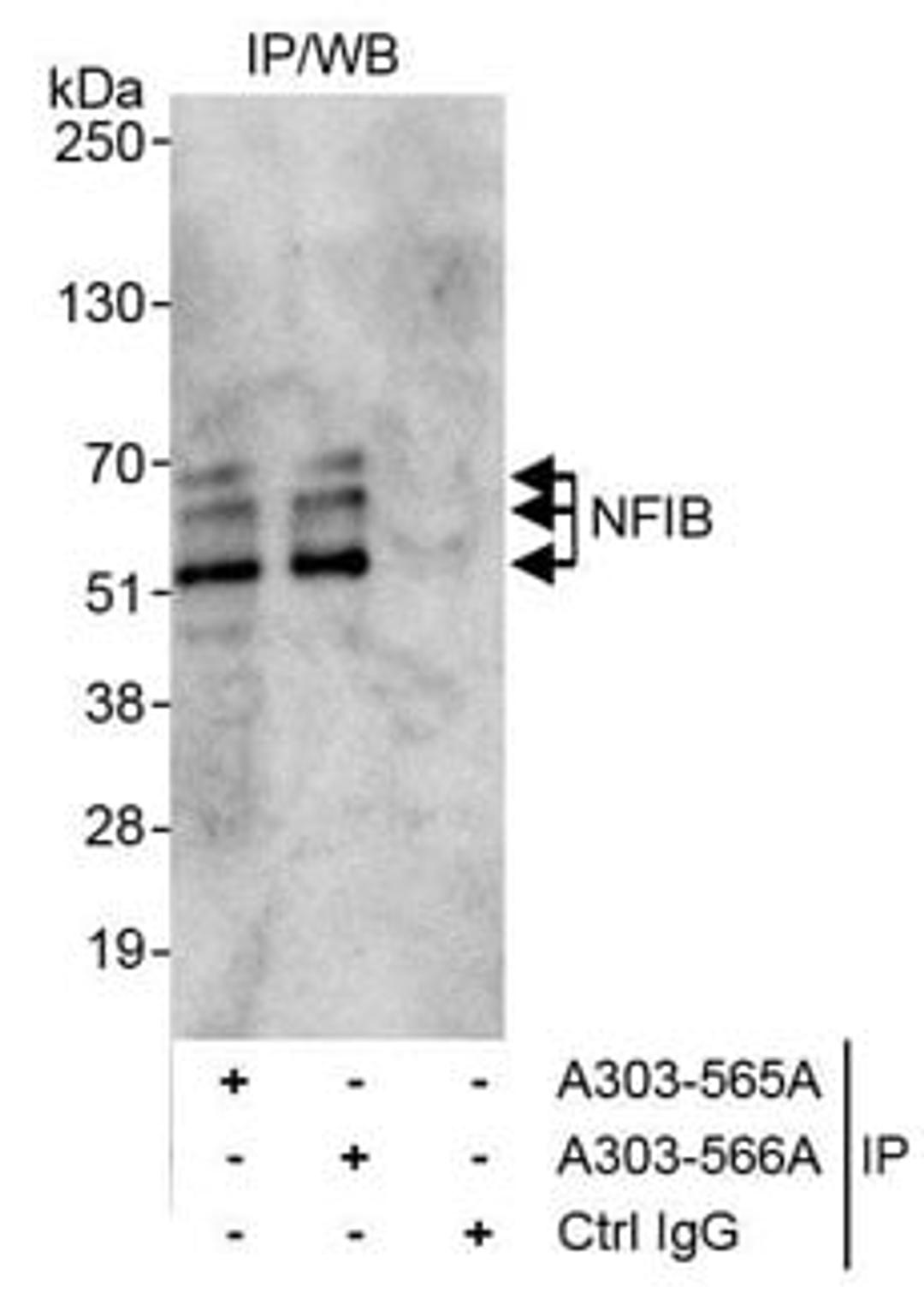 Detection of human NFIB by western blot of immunoprecipitates.