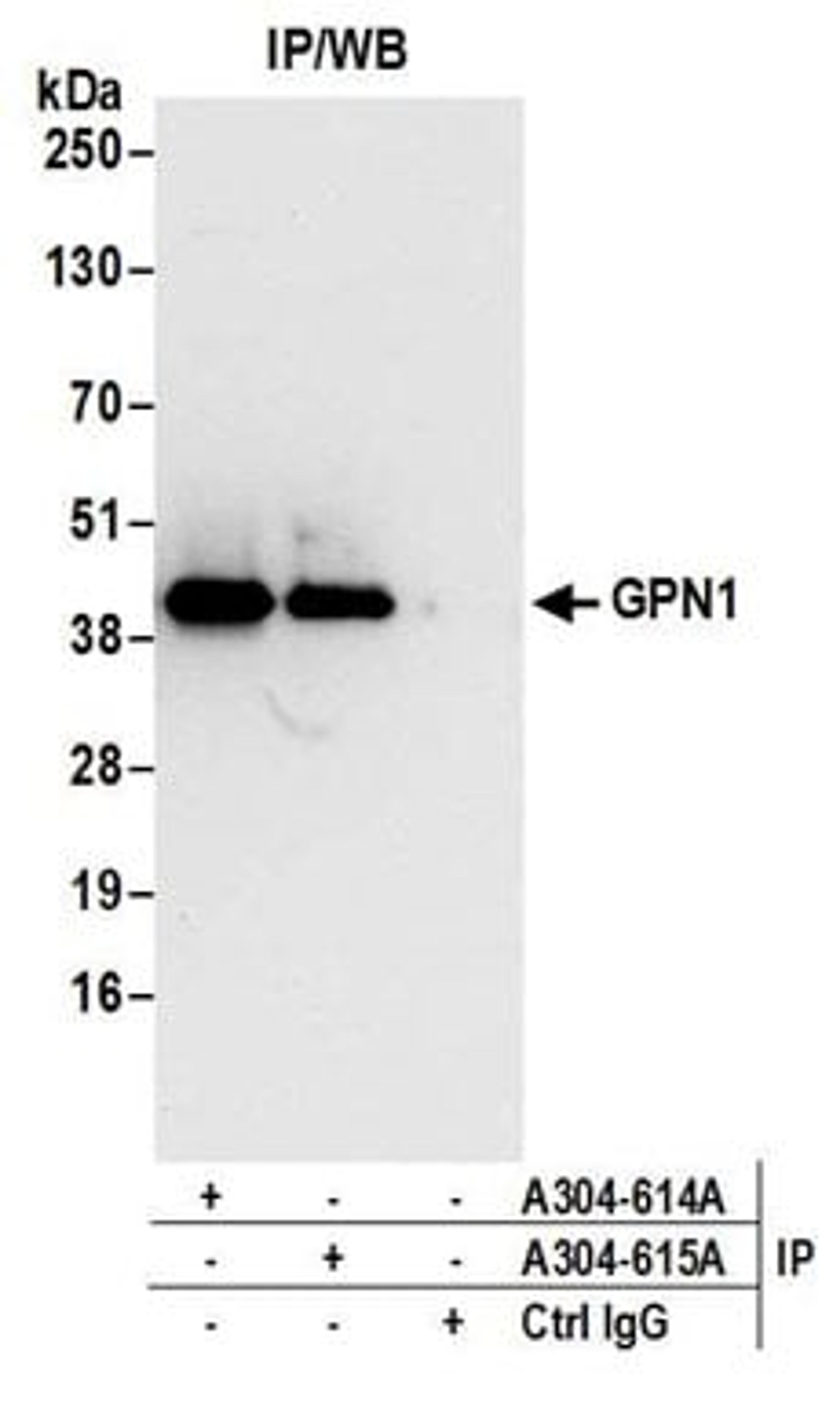 Detection of human GPN1 by western blot of immunoprecipitates.