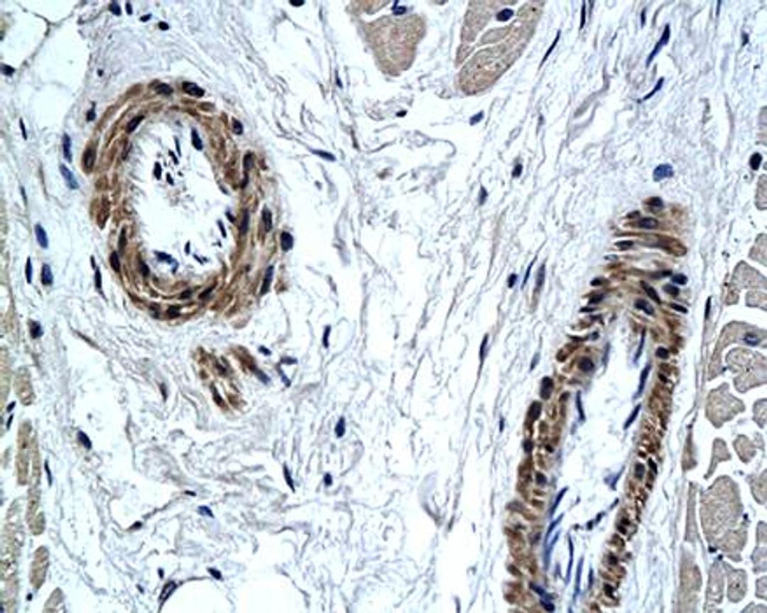 Immunohistochemical analysis of paraffin-embedded human ventricular muscle tissue using PAX7 antibody