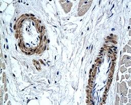 Immunohistochemical analysis of paraffin-embedded human ventricular muscle tissue using PAX7 antibody