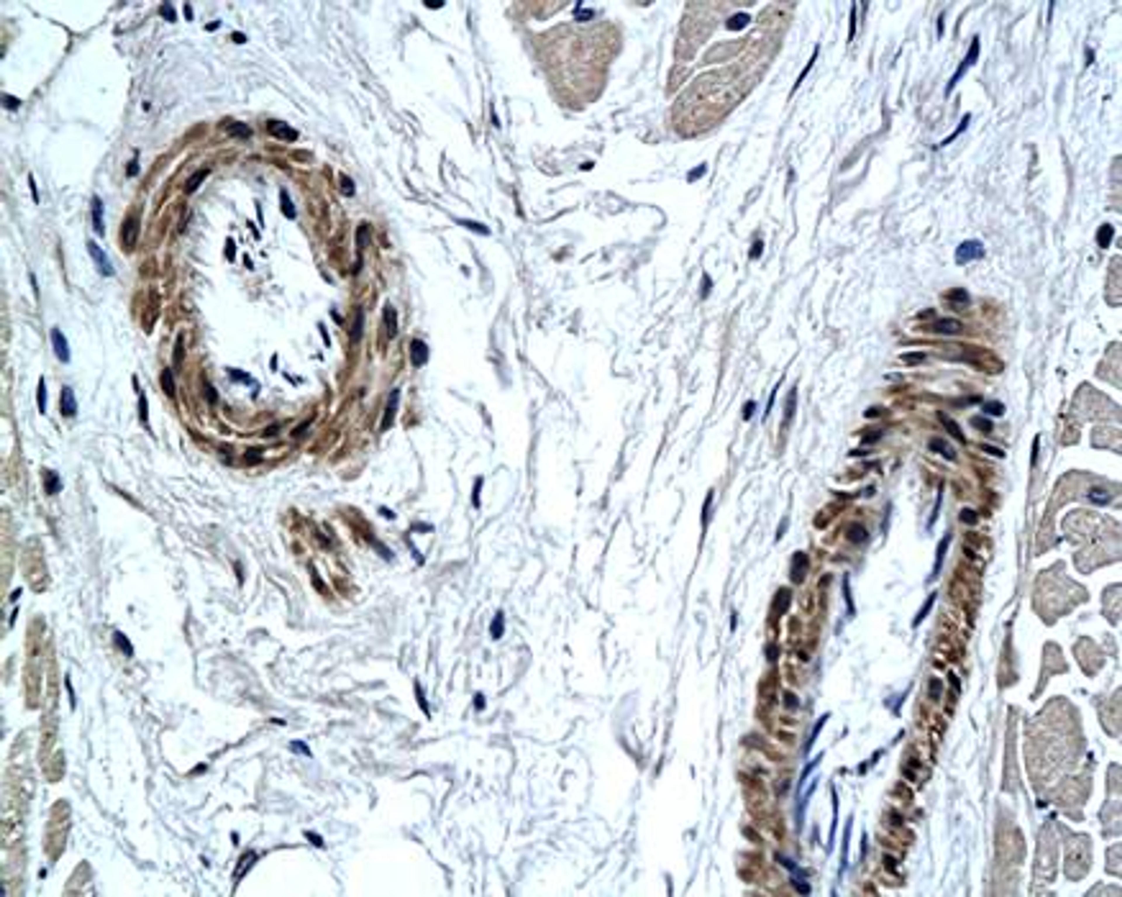 Immunohistochemical analysis of paraffin-embedded human ventricular muscle tissue using PAX7 antibody