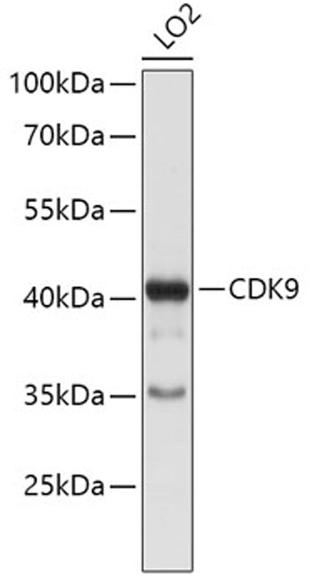 Western blot - CDK9 antibody (A0886)