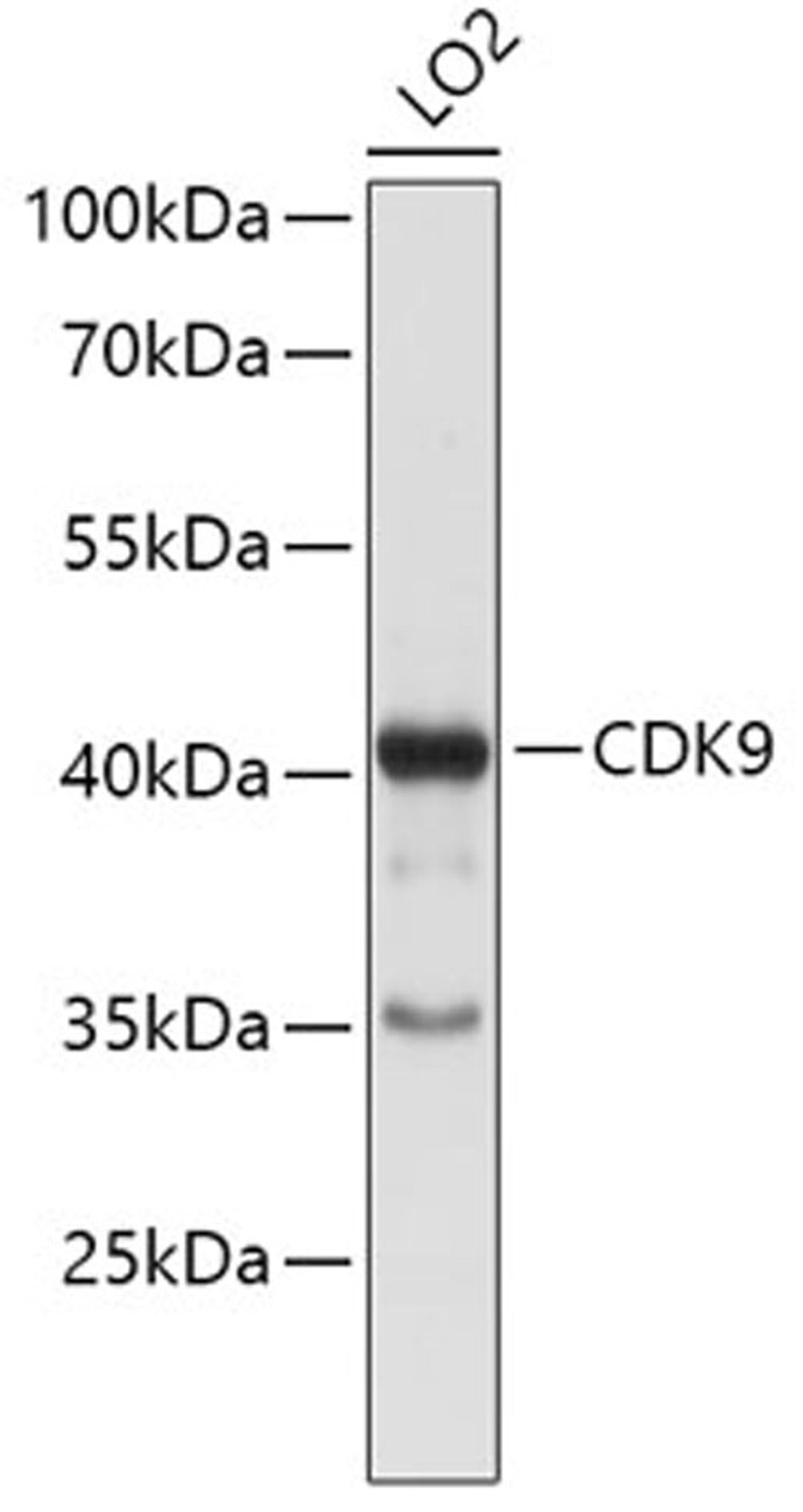 Western blot - CDK9 antibody (A0886)