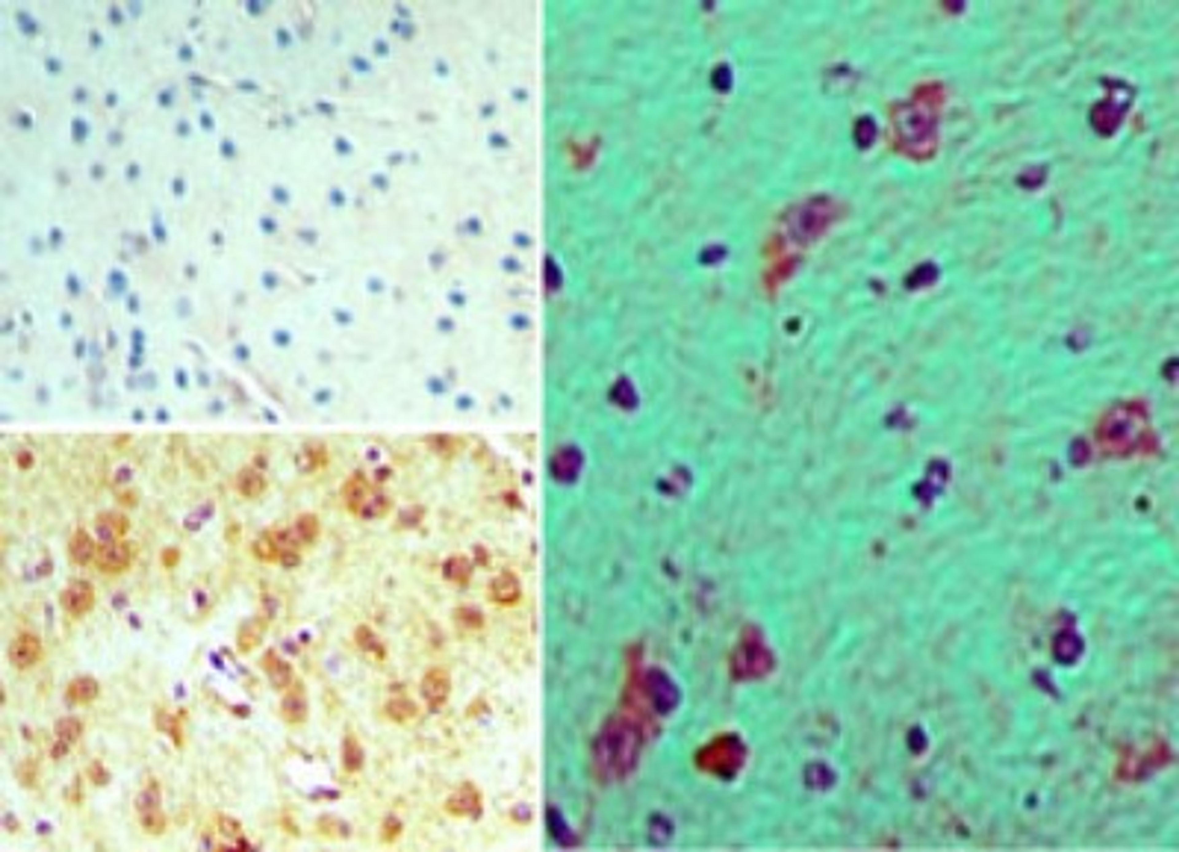 Immunohistochemistry-Paraffin: FHOD3 Antibody [NBP2-24544] - Analysis of FHOD3 in formalin-fixed, paraffin-embedded mouse brain tissue using an isotype control (top left) and this antibody (bottom, right) at 15 ug/ml.