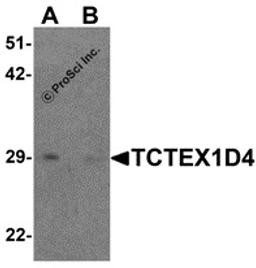 Western blot analysis of TCTEX1D4 in mouse liver tissue lysate with TCTEX1D4 antibody at 1 μg/mL in (A) the absence and (B) the presence of blocking peptide.
