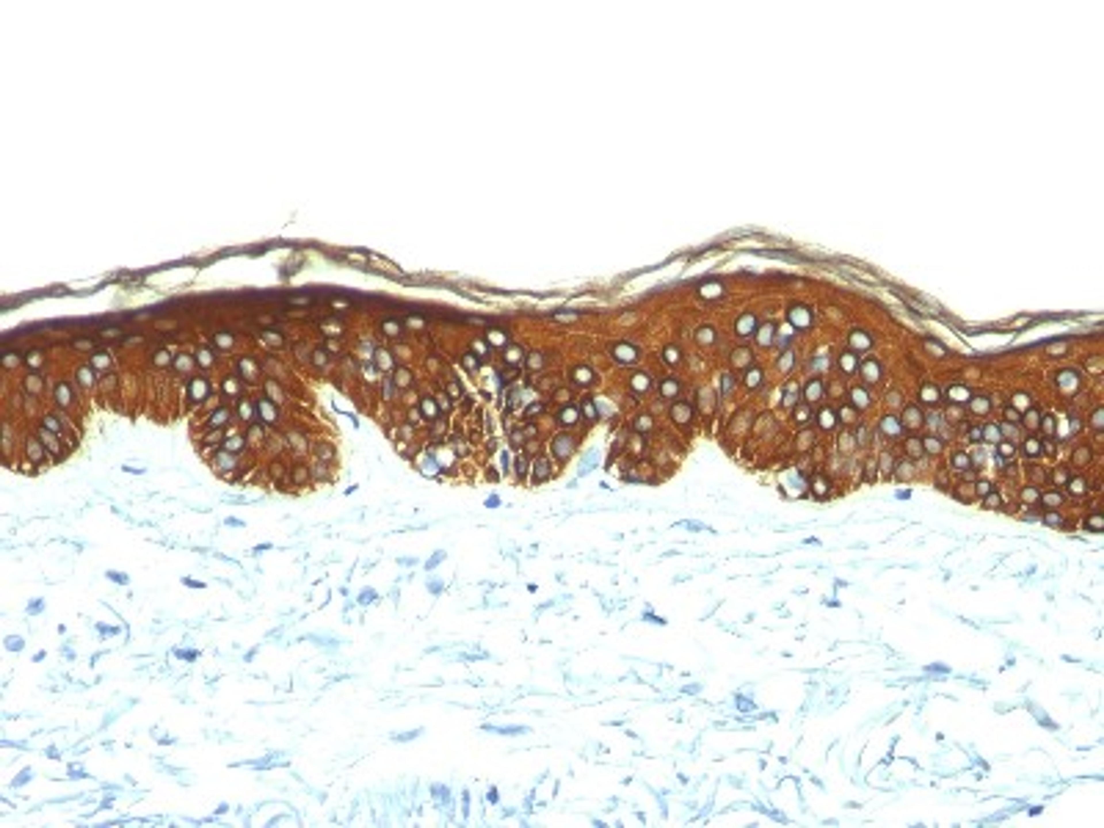 Immunohistochemistry-Paraffin: Cytokeratin, Basic (Type II or HMW) Antibody (SPM116) [NBP2-34348] - Formalin-fixed, paraffin-embedded skin stained with Cytokeratin, HMW MAb (SPM116).