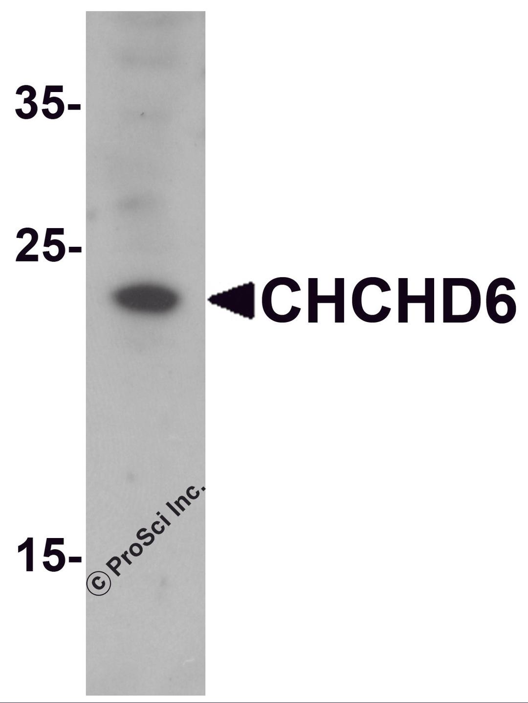 Western blot analysis of CHCHD6 in SK-N-SH cell lysate with CHCHD6 antibody at 1 μg/mL.
