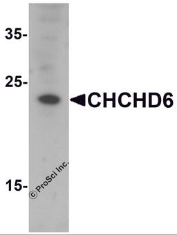 Western blot analysis of CHCHD6 in SK-N-SH cell lysate with CHCHD6 antibody at 1 μg/mL.