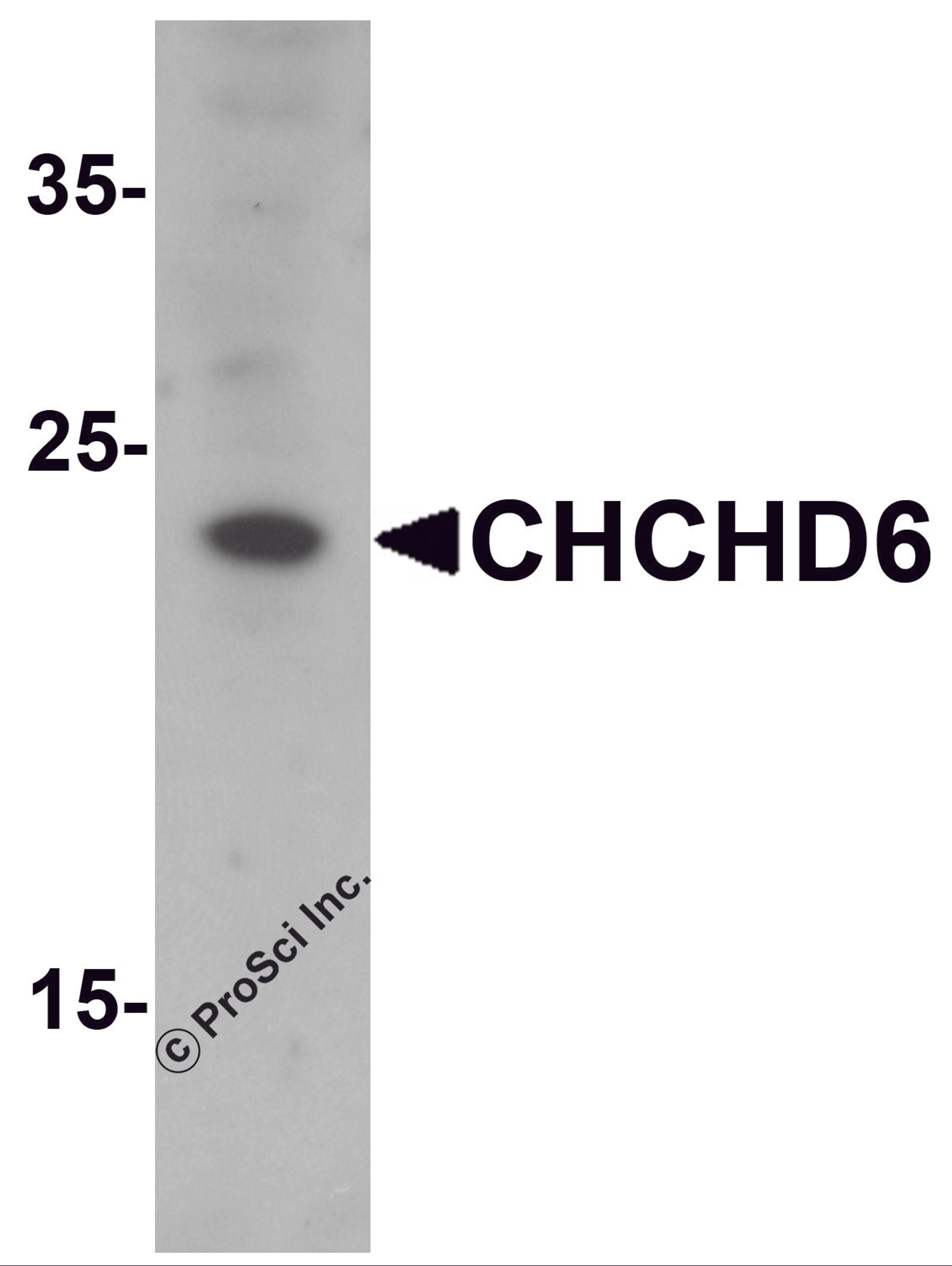 Western blot analysis of CHCHD6 in SK-N-SH cell lysate with CHCHD6 antibody at 1 μg/mL.